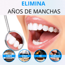 Smile White™ — El Lápiz Blanqueador 4X Más Potente