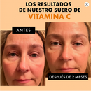 RadiantC Sérum Facial – ¡Llévate 2x1! Piel Más Joven + Envío Gratis + 49% DCTO