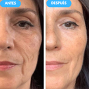 NidaGlow™ – Crema Antiedad con Colágeno y Efecto Rejuvenecedor 2x1 OFERTA