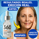 Simpla PE T4: El Avanzado Suero Antiedad para Arrugas y Manchas