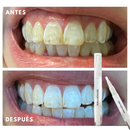Smile White™ — El Lápiz Blanqueador 4X Más Potente