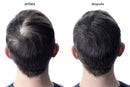 OUHOE Hair Elixir – Recupera tu Cabello Naturalmente