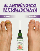 Fungivex | Tratamiento eficaz que elimina el 99.9% de los hongos — ¡Oferta 2×1!