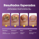 Aureva™ Fungivex Oil – Tratamiento para Hongos + ¡Promo 2x1 por Tiempo Limitado