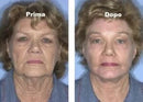 Q10 Mask – Piel Joven al Instante en 5 Minutos