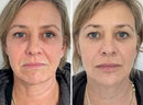 LA CREMA ANTI-EDAD ITALIANA QUE BORRA AÑOS — SIN AGUJAS, SIN CIRUGÍA