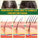 OUHOE Hair Elixir – Recupera tu Cabello Naturalmente