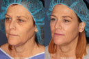 Le presentamos la Crema Antiarrugas