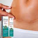 Spray Médico Regenerador de Cicatrices – Piel Lisa y Uniforme en Semanas